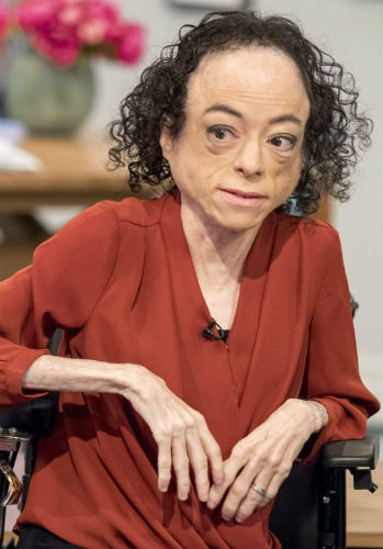 Liz Carr Bio Liz Carr